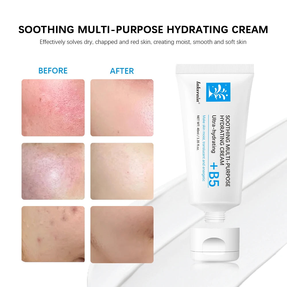 Soothing Multi-Purpose Hydrating Cream Reduces Redness Daily Helps Relieve Rough Cracked Skin Deep Skin Care